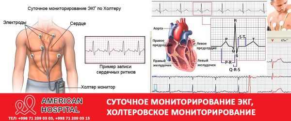 Холтеровское мониторирование