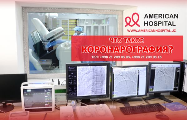 Что такое коронарография?