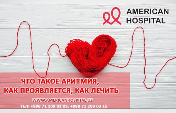 Что такое аритмия, как проявляется, как лечить?