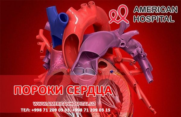 Пороки сердца