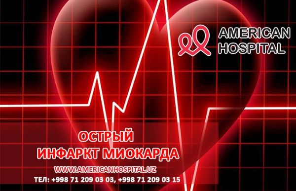 Острый инфаркт миокарда