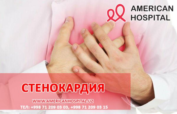 Стенокардия