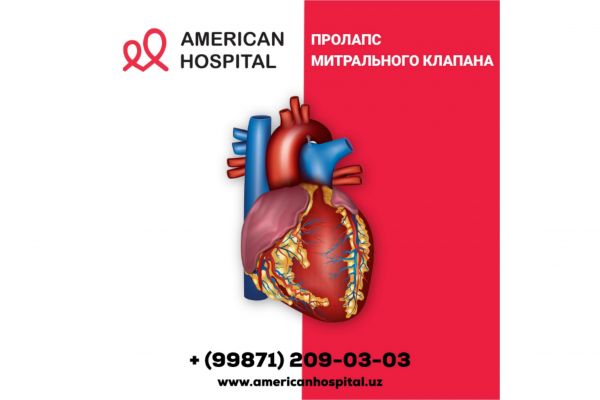Пролапс митрального клапана