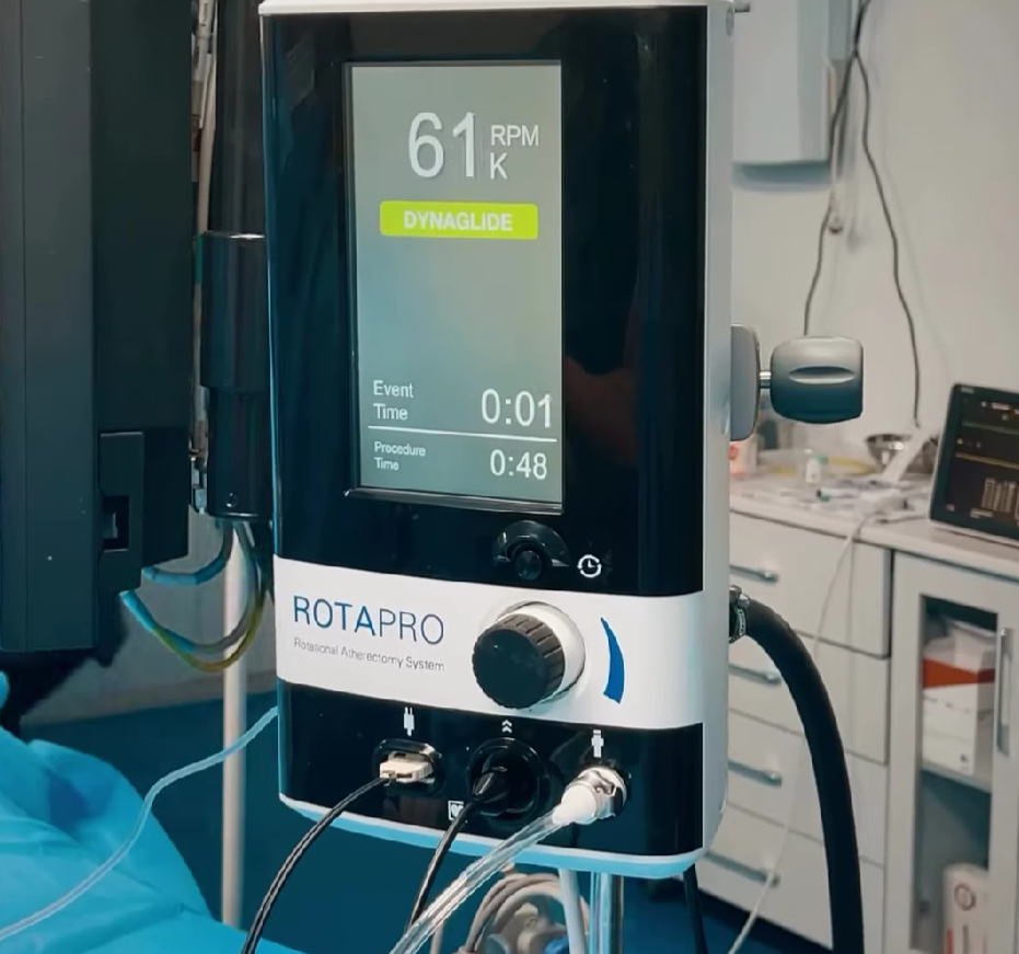 С использованием системы RotaPro выполняется ротационная атерэктомия