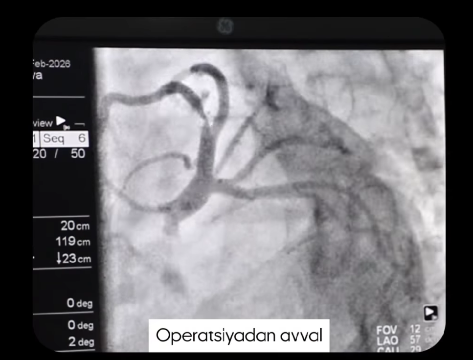  Bu — oddiy jarrohlik emas