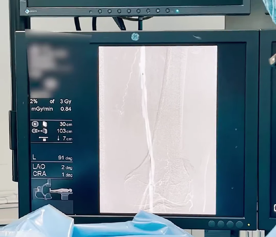 Ba’zan oyoqlardagi og‘riq, sovuq hissi yoki tez charchash oddiy muammo emas